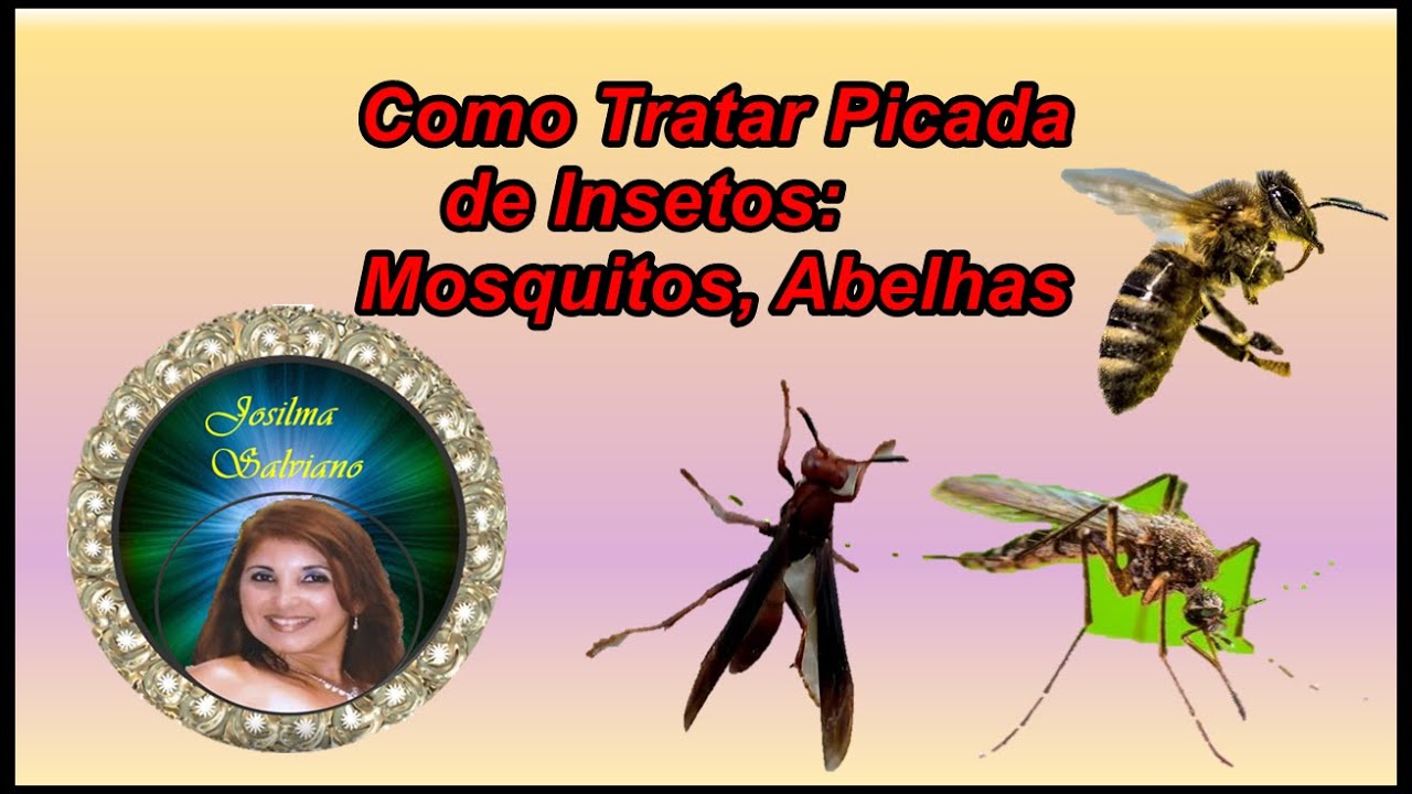 Como tratar picada de insetos, mosquitos, abelhas, etc
