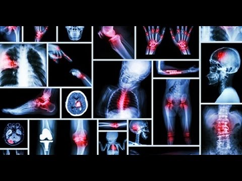 18 Dores no Corpo Que Estão Diretamente Ligadas as Suas Emoções