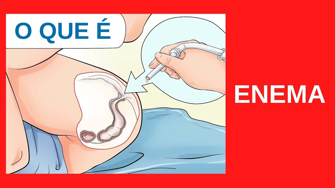 O que é ENEMA ou LAVAGEM INTESTINAL
