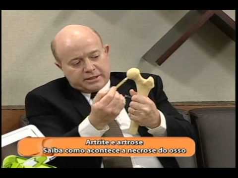 Artrite e Artrose, tratamentos - Programa Viver é melhor - Boa Vontade TV - 28.set.2012
