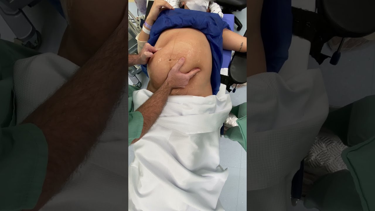 Colocando o bebê na posição certa (Versão Cefálica Externa)