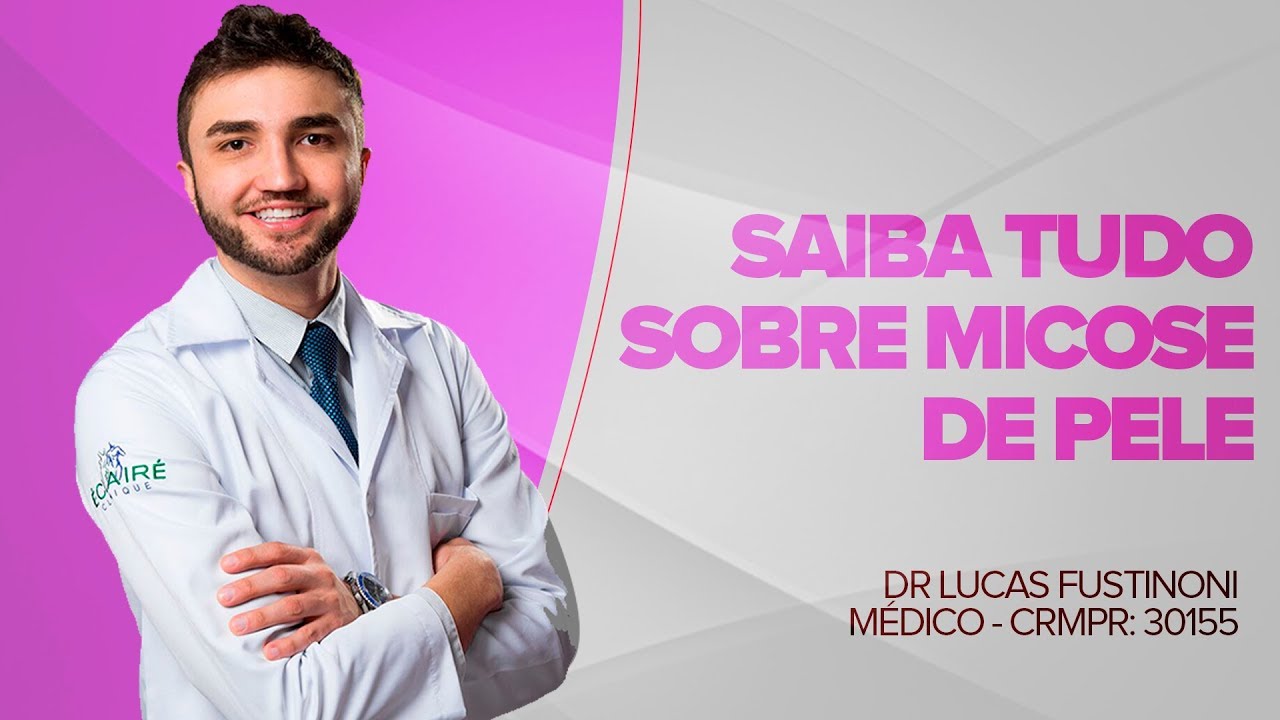 Saiba tudo sobre Micoses de Pele | Dr Lucas Fustinoni - Médico - CRMPR: 30155