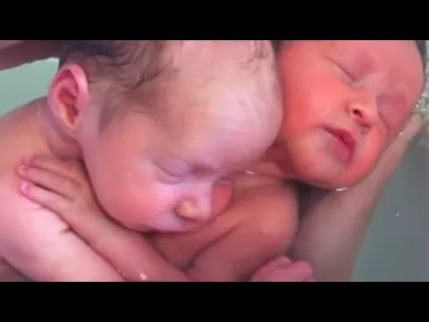 Newborn Twins Who Don’t Realize They’ve Been Born Refuse To Stop Hugging One Another
