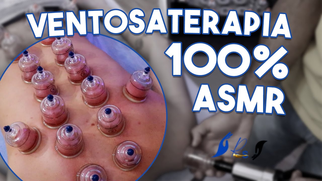 VENTOSATERAPIA PARA DORES NAS COSTAS E 100% ASMR #libertadordedores #asmr #ventosaterapia