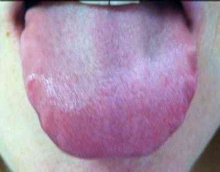 55b233b80ab41eabbbd373ebfe38bb56