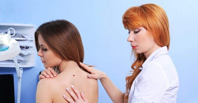 autoexame para detectar câncer de pele