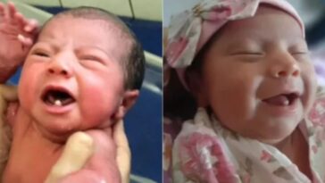 nasceu com dois dentes