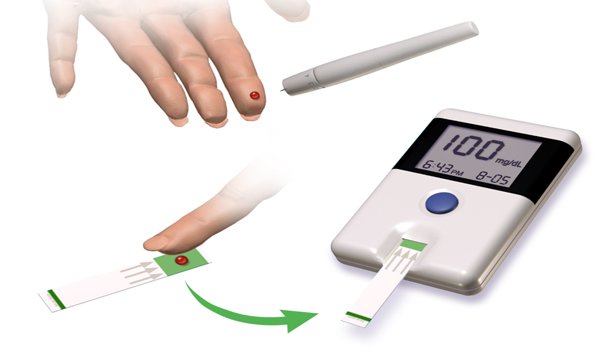 Blausen_0301_Diabetes_GlucoseMonitoring
