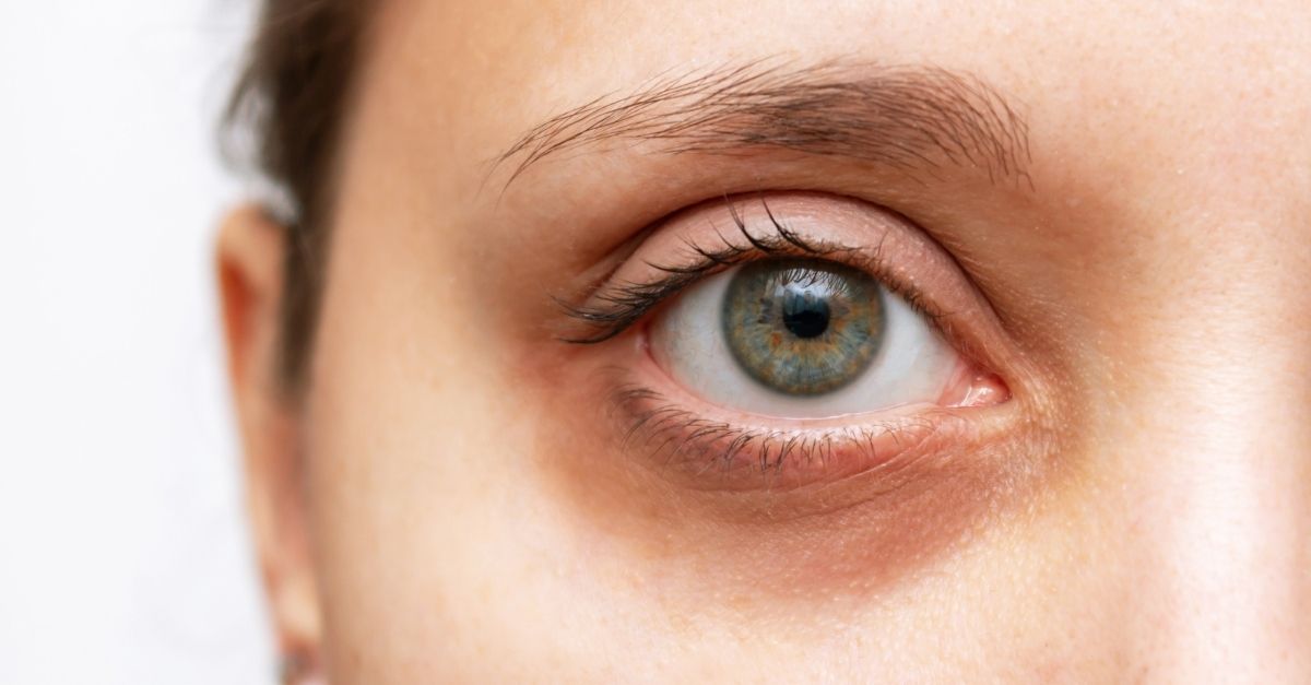 Camuflagem de olheiras