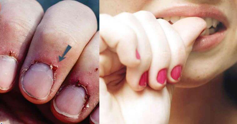 não arranque as cutículas