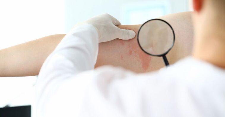 Doenças de pele comuns