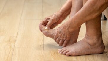 Doenças nos pés de idosos