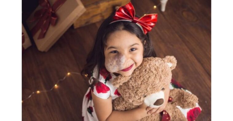 Garotinha com tumor no rosto