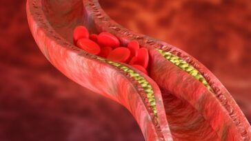 Hábitos que pioram o colesterol