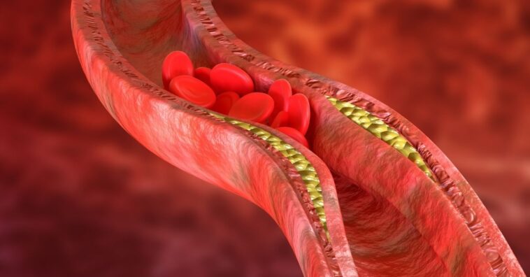 Hábitos que pioram o colesterol