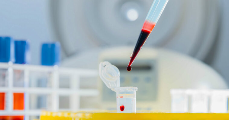 Homem investigado por omitir HIV