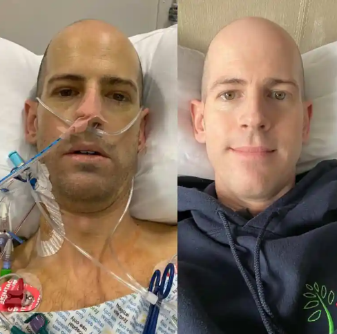 antes e depois do transplante de fígado
