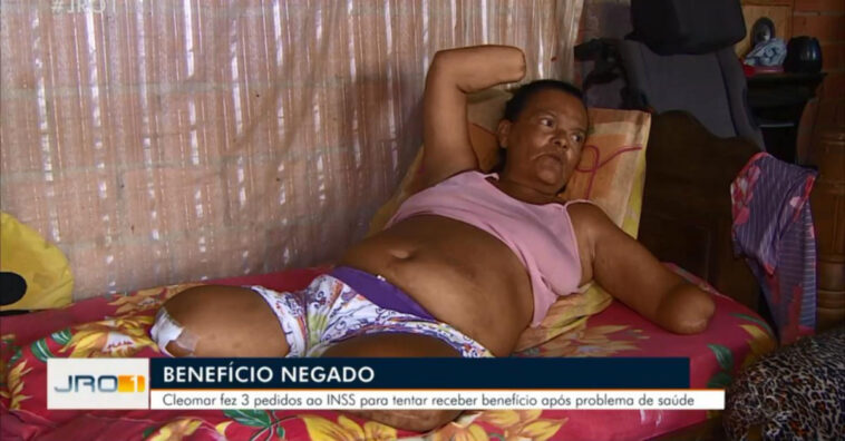 INSS nega benefício por falta de assinatura de mulher que não tem braços e pernas