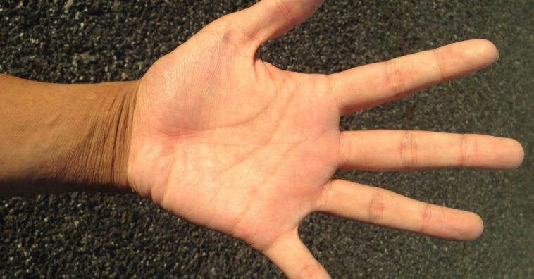 Linhas da palma da mão