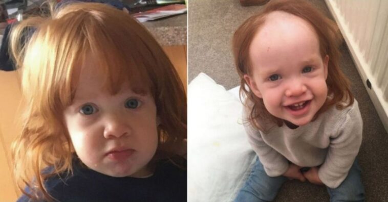 Menina confunde gel de cabelo com creme depilatório