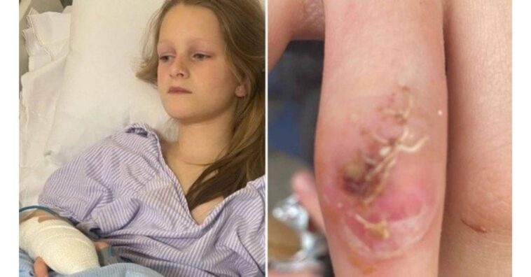 Menina de 9 anos quase morre depois de mordida de hamster