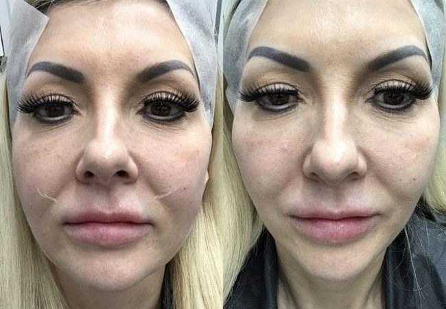 Mulher gastou R$ 141 mil para parecer com a Barbie conheça a história