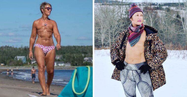 Mulher mostra orgulho do próprio corpo depois de dupla mastectomia