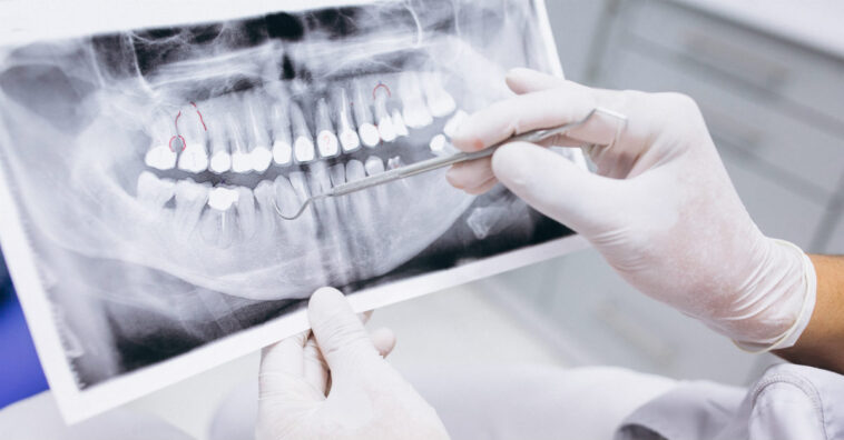 Mulher perde 15 dentes por causa de procedimento mal feito