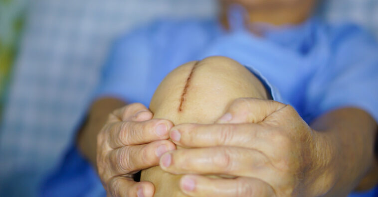 Nova cola promete fechar qualquer ferida em 3 minutos