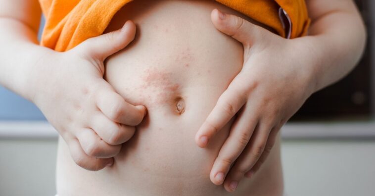 Permanganato de potássio