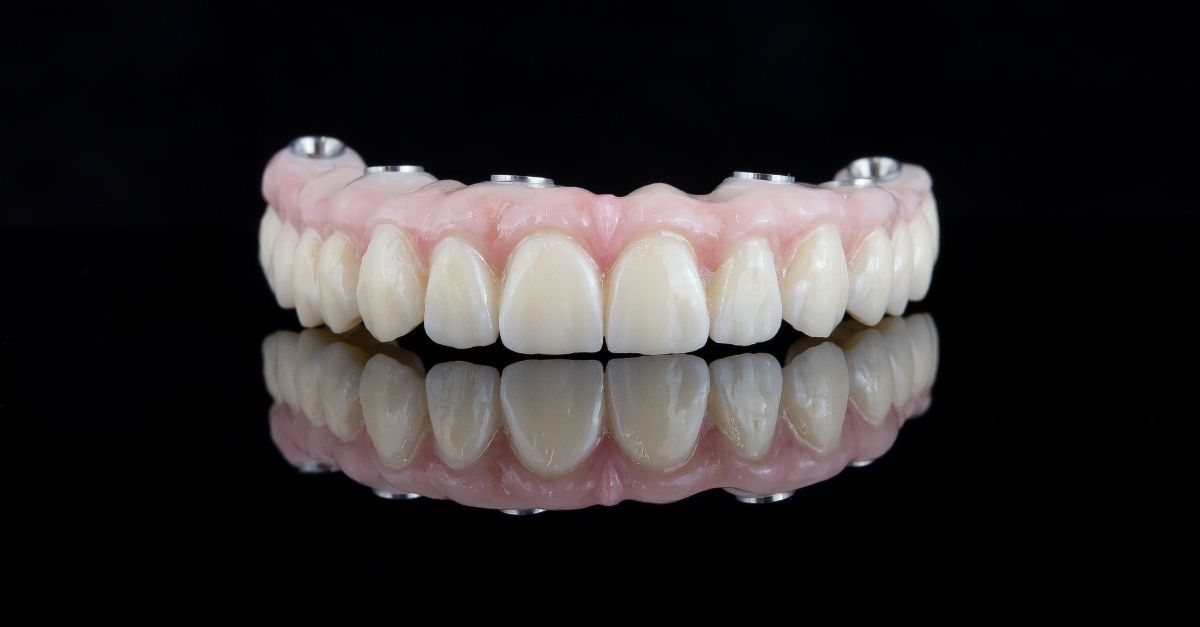 Prótese dentária móvel, semifixa ou fixa