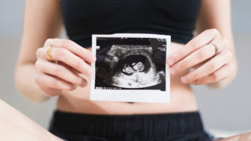 ultrassonografia retratando a Virgem Maria