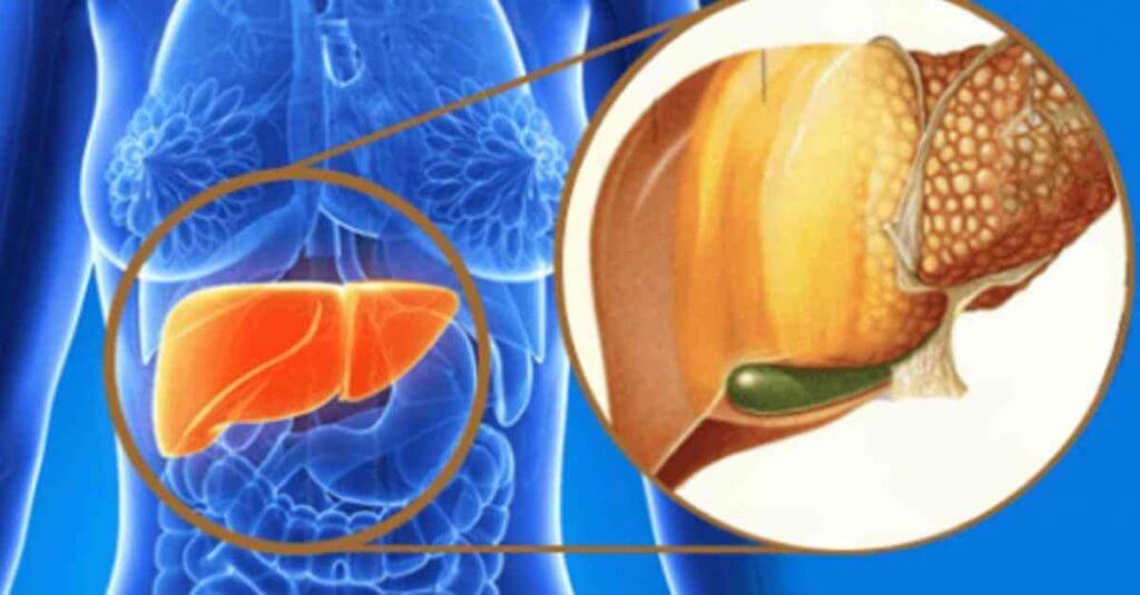 alimentos_danificam_figado