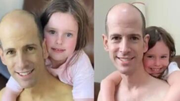 antes e depois do transplante de fígado