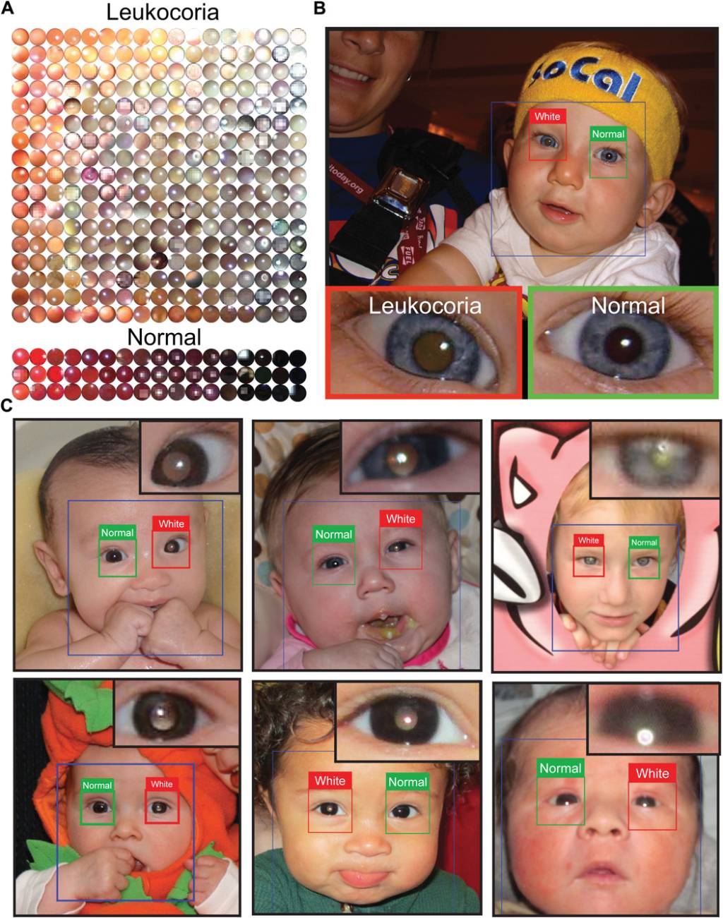 aplicativo detecta problemas de visão
