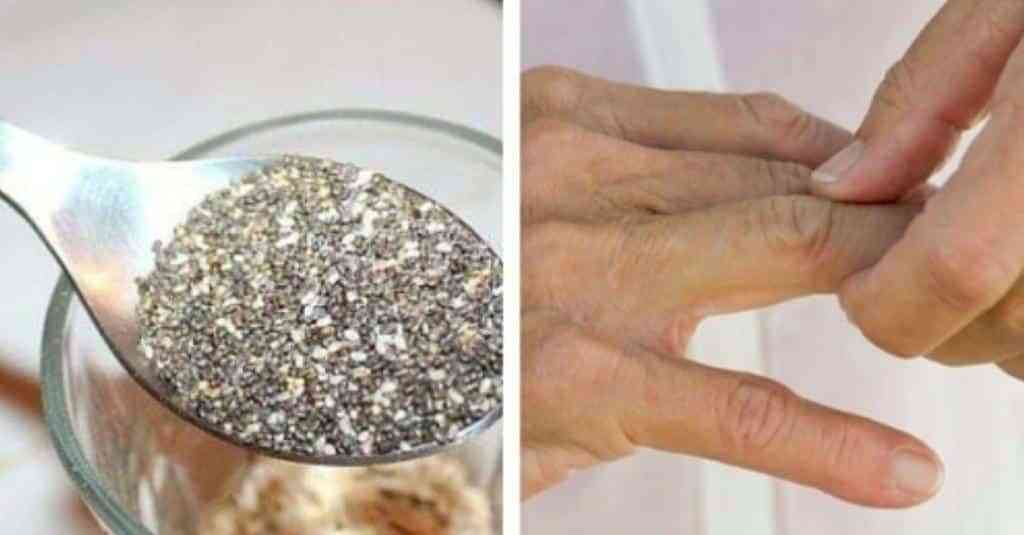 Artrite - Reduzir a artrite com ácidos graxos