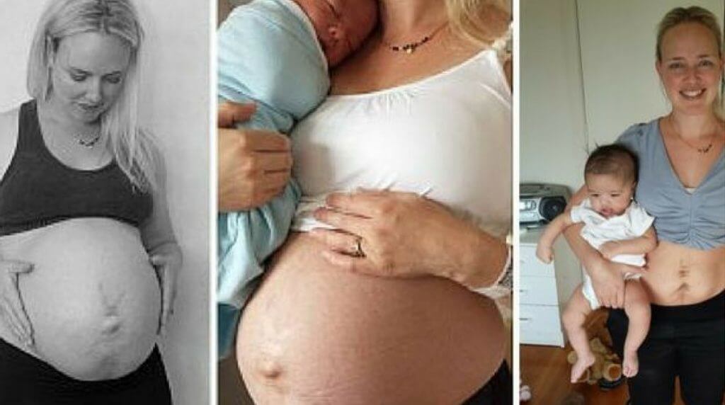 Barriga Depois Do Parto Tem Que Ser Perfeita 