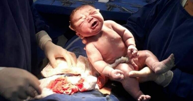 bebê nasce com cinco quilos