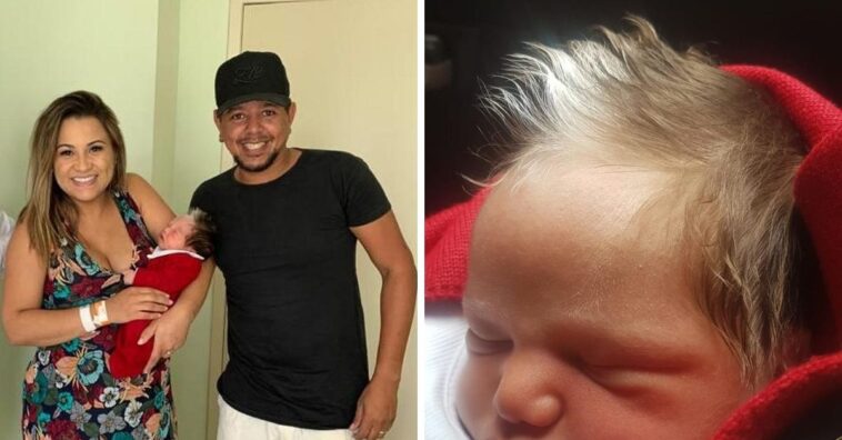 bebe nasce com mecha branca