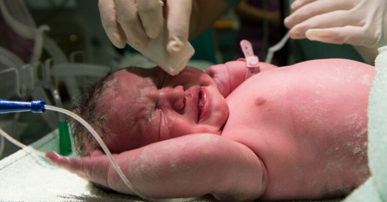 bebês que nascem com rabo