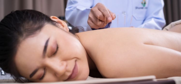 beneficios da acupuntura estética