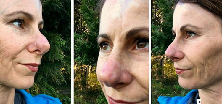 bálsamo homeopático dissolve nariz entenda a história