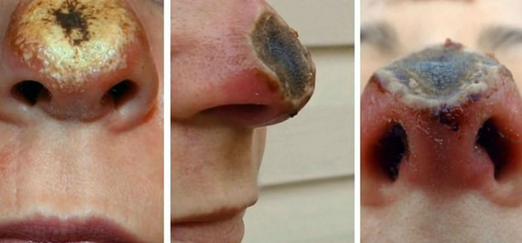 bálsamo homeopático entenda