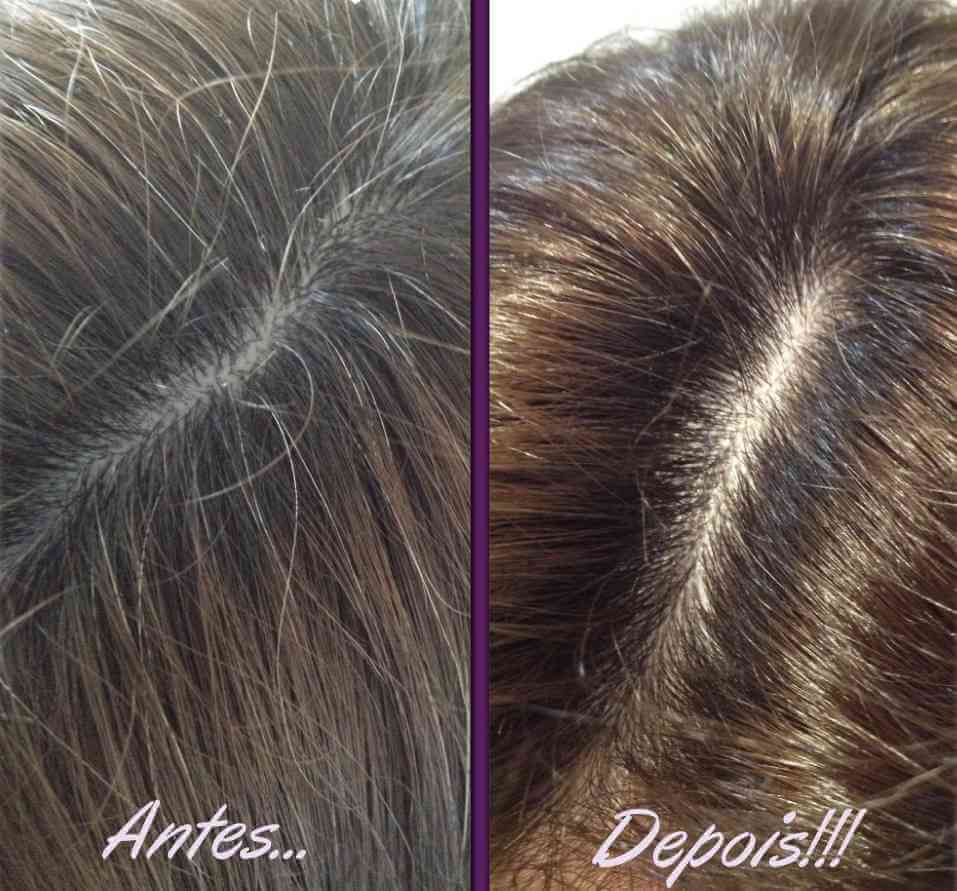 cabelo-branco-antes-depois