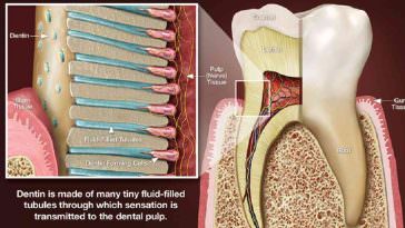 canal da raiz do dente