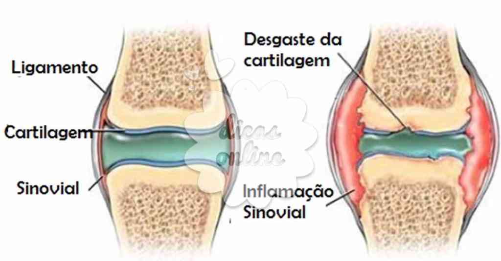 cartilagem_2_dicas_online