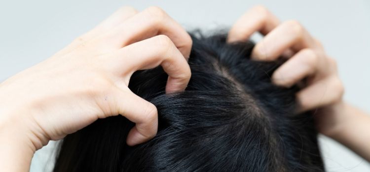 causas de ter espinha na cabeça