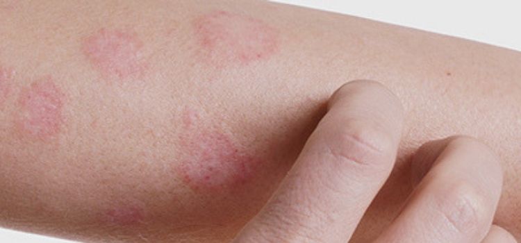 sete causas de manchas vermelhas na pele