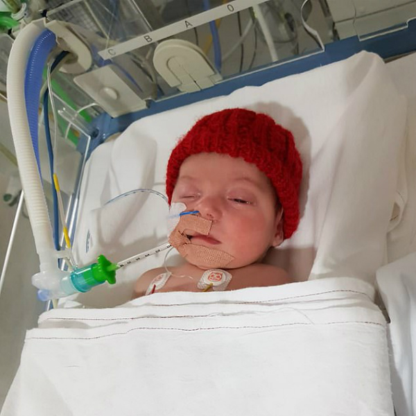 coma causado por um beijo história