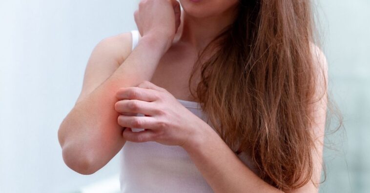 como é alergia à água